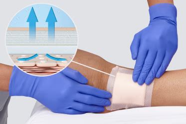 Prevent Pressure Injuries With A 5 Layer Bordered Foam Dressing Medline